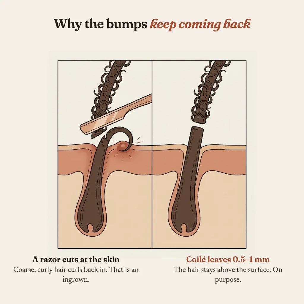 A razor cuts at the skin while Coilé leaves 0.5 to 1 mm on purpose