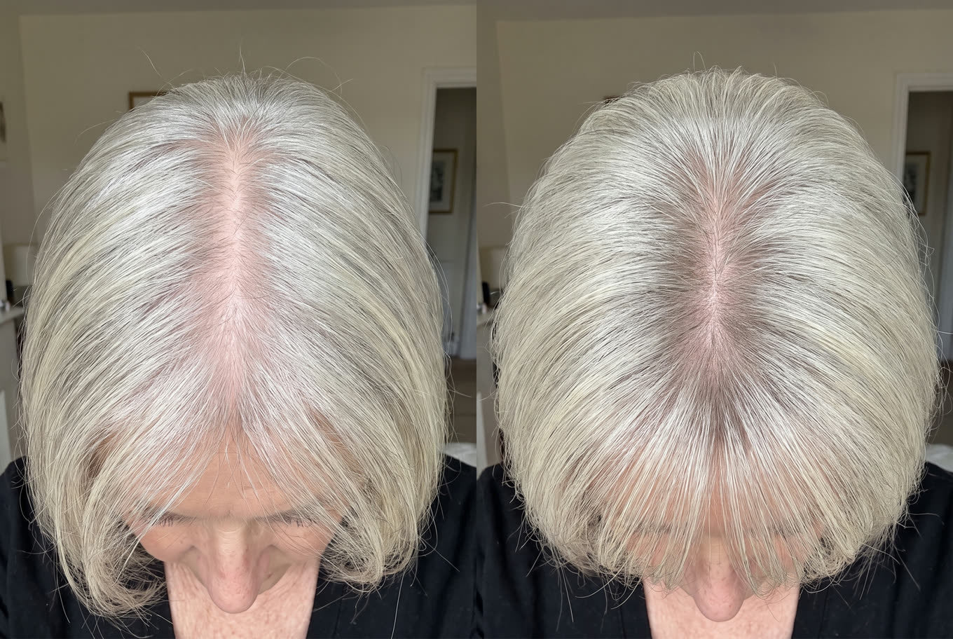 The same parting ten minutes apart, scalp showing then covered